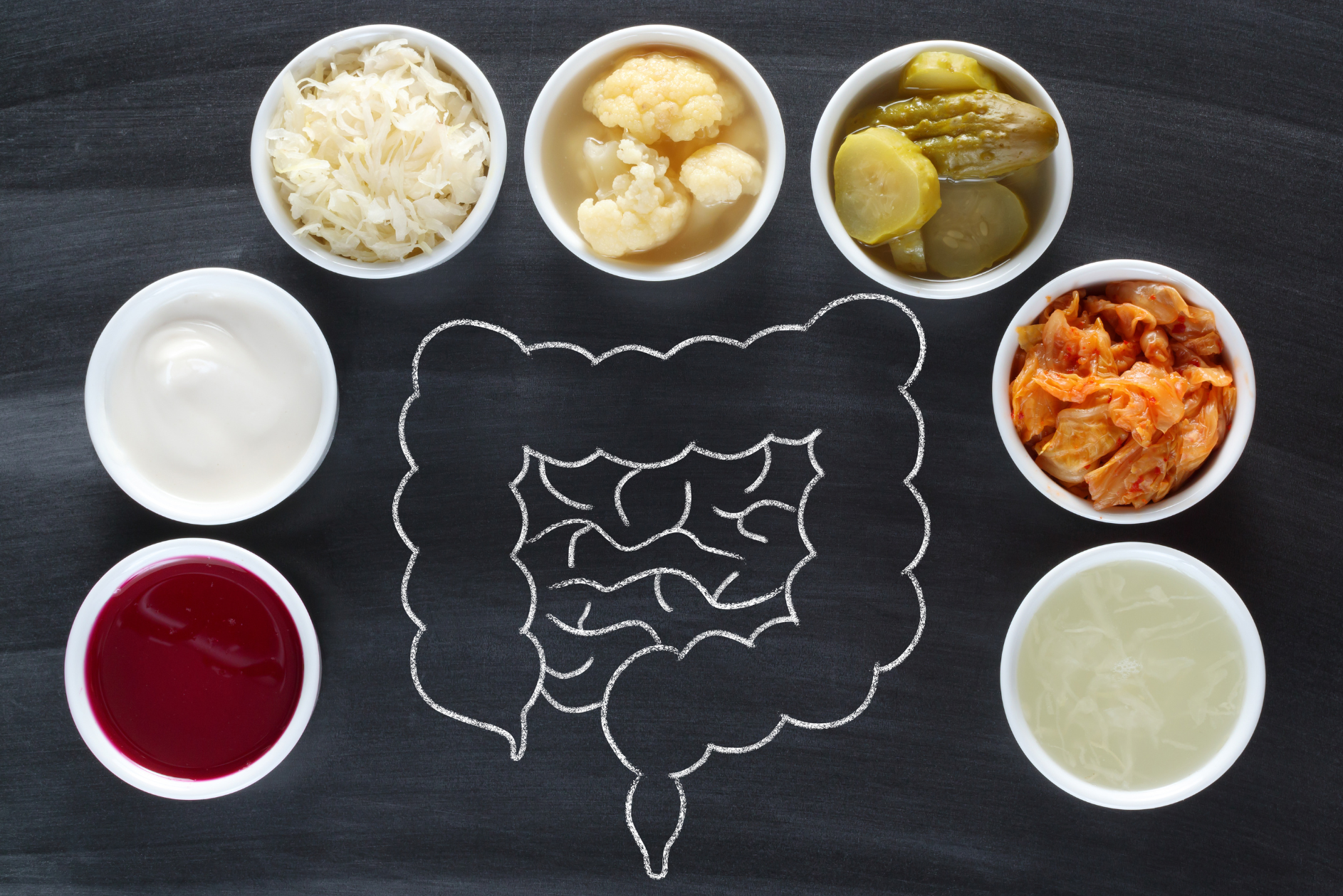 Can Probiotics Improve Your Gut Health?